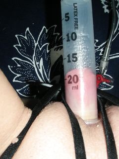 Pompatura di clitoride 2