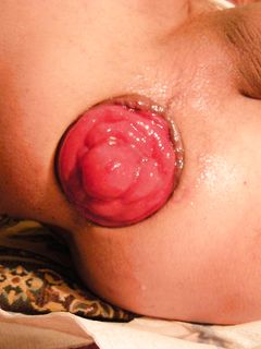 roselline ,rose , o prolassi... come volete voi....:)