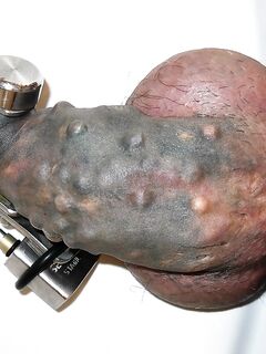 cazzo pene chiuso a chiave in castità