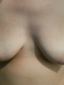 capezzolini birichini