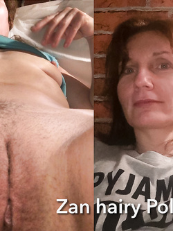 Zan 45 yo Polish hairy slut