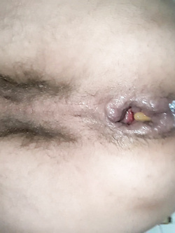 self hole