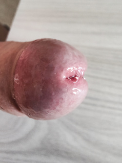 Oggi a proprio voglia di essere svuotato