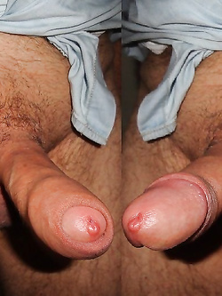 IL MIO GLANDE CON UN MICROCAPEZZOLO SULLA PUNTA