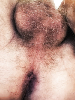 Tolenerox arty anal horny selfies