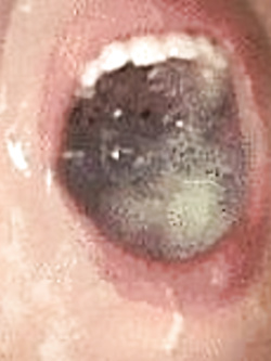 LILA -  PORCELLA DI GENOVA